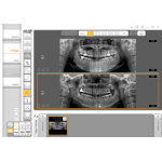 * Rayscan α-SC Ceph